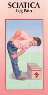 Sciatica (Leg Pain) Brochure